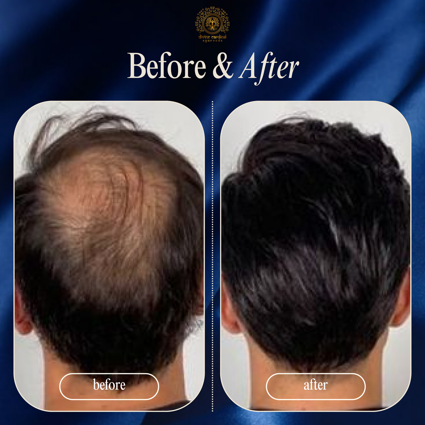 Juniper Berry Anti Hair-Loss Hair Oil