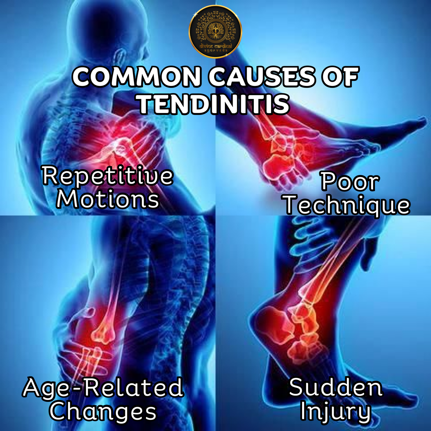 Cypress Tendinitis Relief Oil