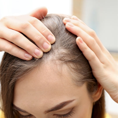 HAIR LOSS