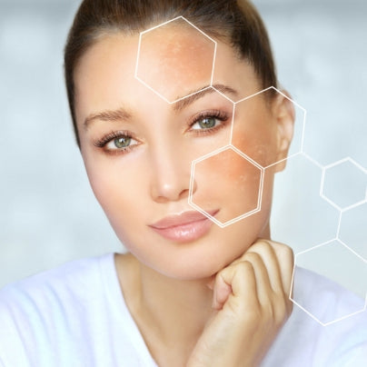 DRY-DULL SKIN