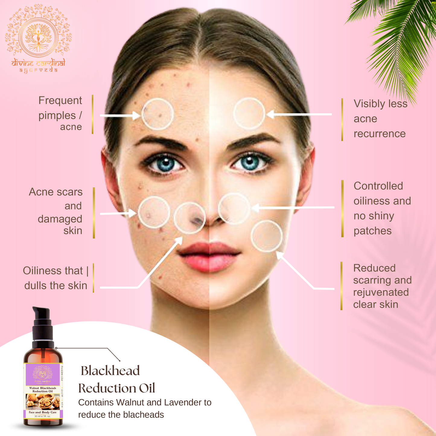 Walnut Body  Massage Oil