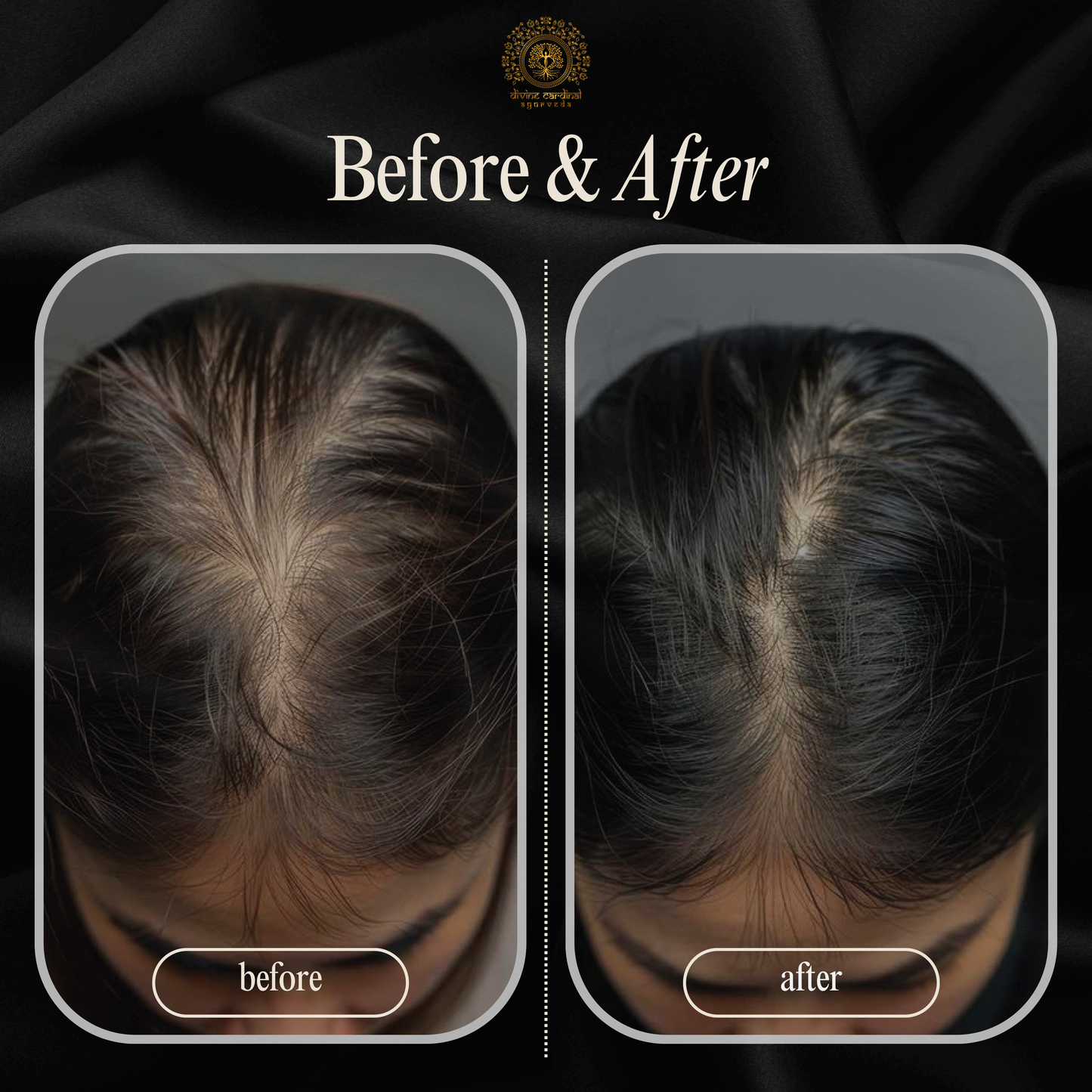 herbal oil for hair fall and regrowth