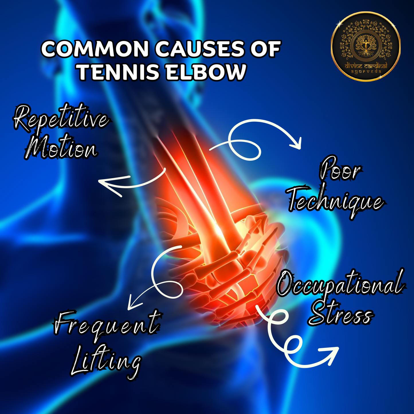 Immortelle Tennis Elbow Relief Oil | Lateral Epicondylitis Pain Oil